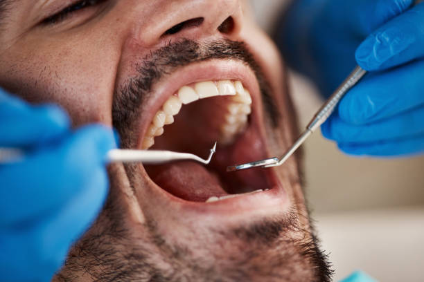 Best Mobile Emergency Dentist in Covington, OH
